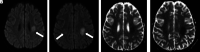 Figure 10.