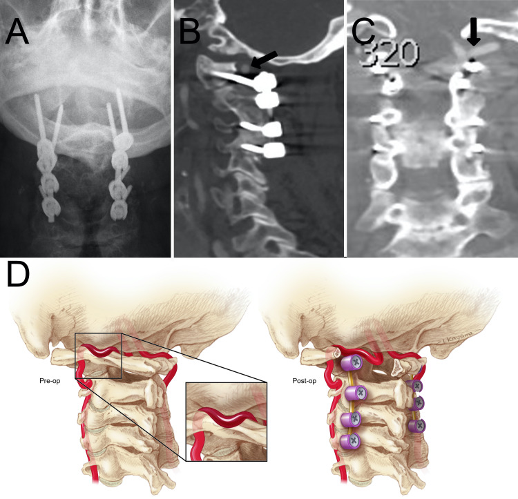 FIG. 2.