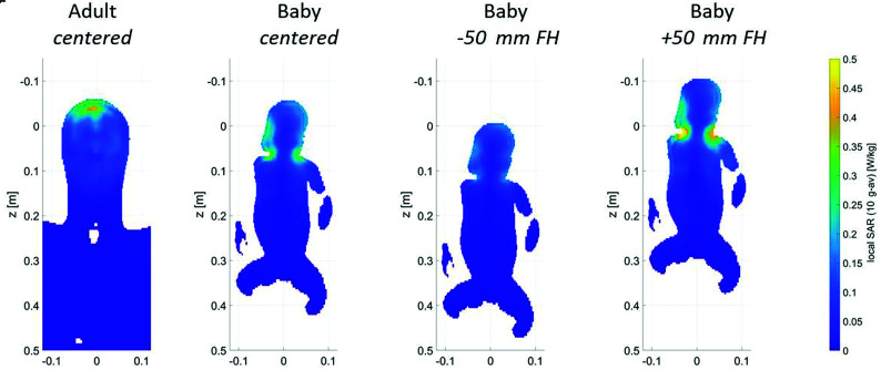 Fig 3.