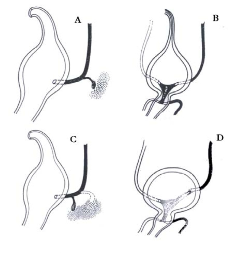 Fig. (1)