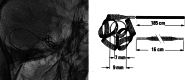 FIG 1.