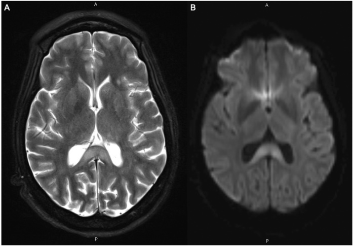 Fig. 2