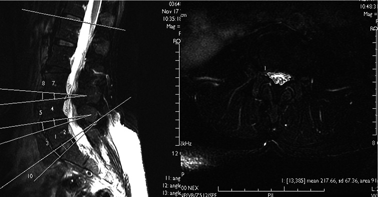 Fig. 1