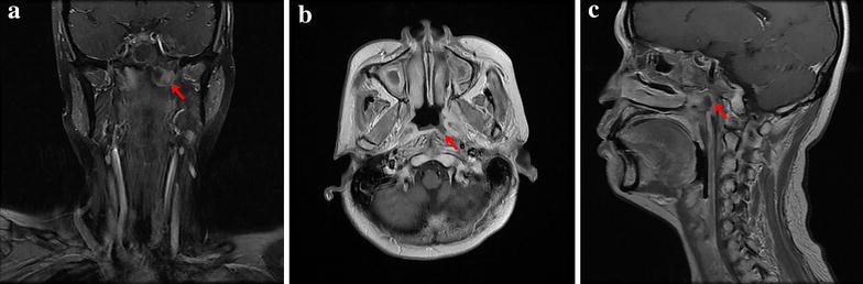 Fig. 1