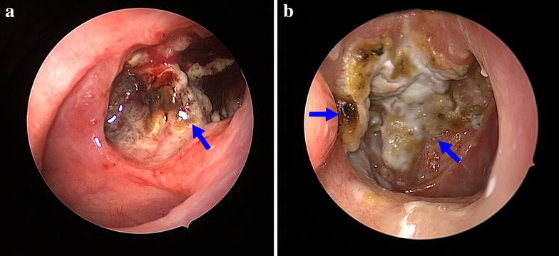 Fig. 3