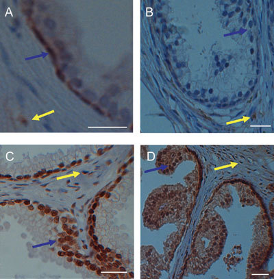 Figure 1S