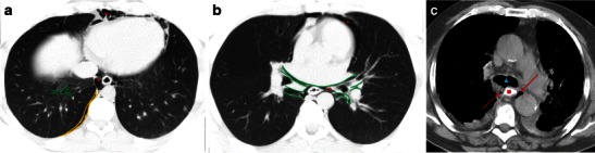 Fig. 5