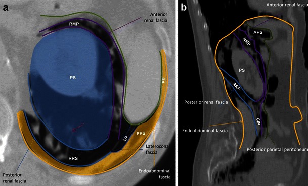 Fig. 10