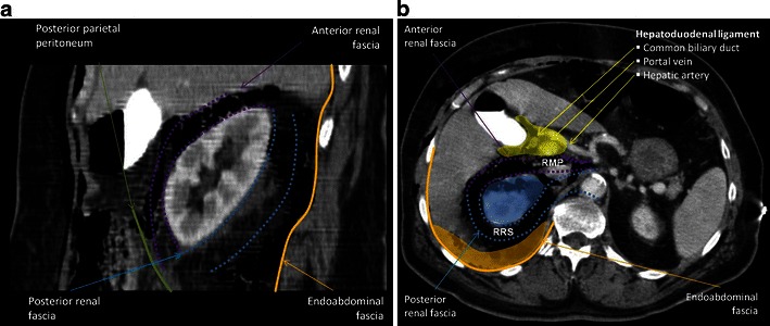 Fig. 11