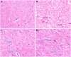 Fig. 11