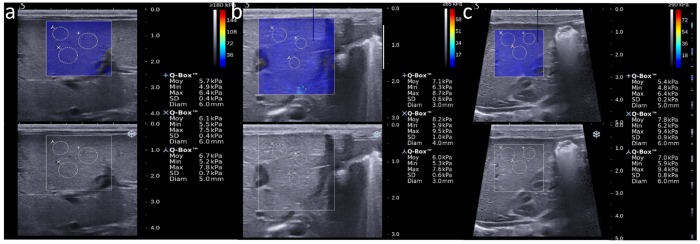 Fig 1