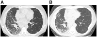 <sc>Fig</sc>. 1