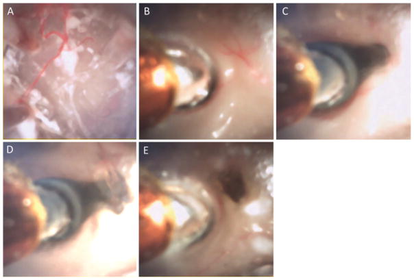 FIG. 10