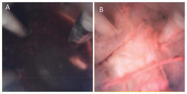 FIG. 8