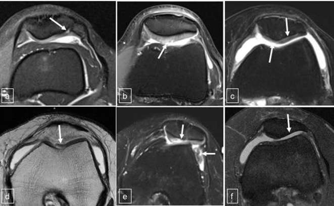 Current clinical, radiological and treatment perspectives of ...