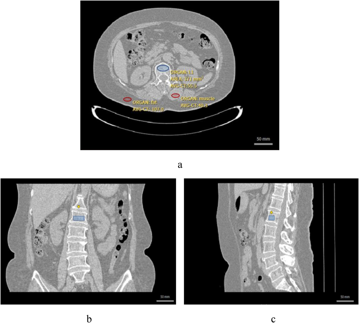 Figure 2