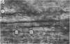 162-3