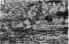 162-2
