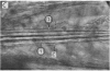 162-1