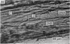 162-2