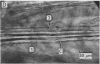 162-1
