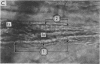 162-2