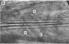 162-1