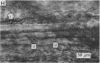 162-3