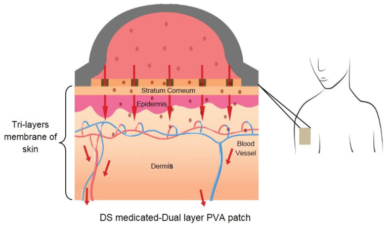 Figure 11