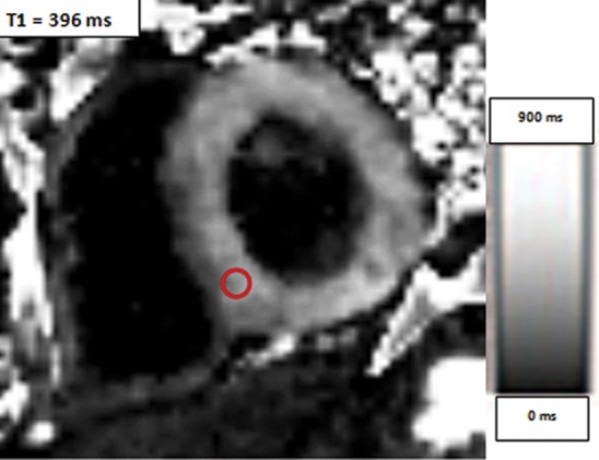 Figure 13b