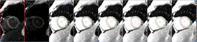 Figure 14b