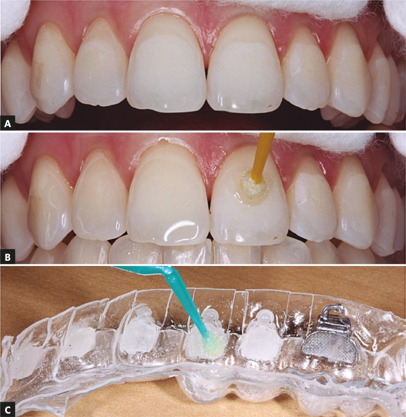 Figure 15.