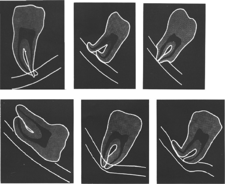 Fig. 4