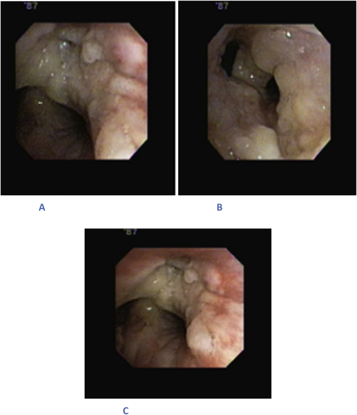 Fig. 1