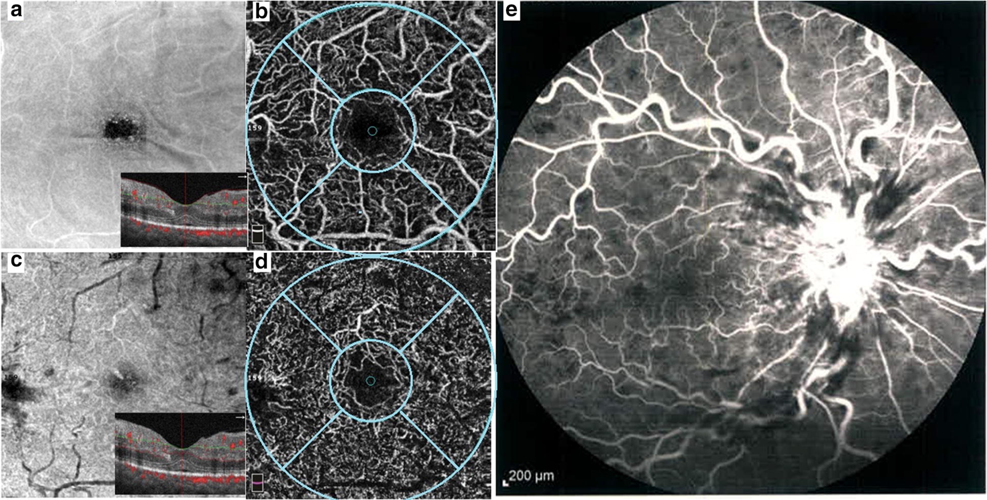 Fig. 2