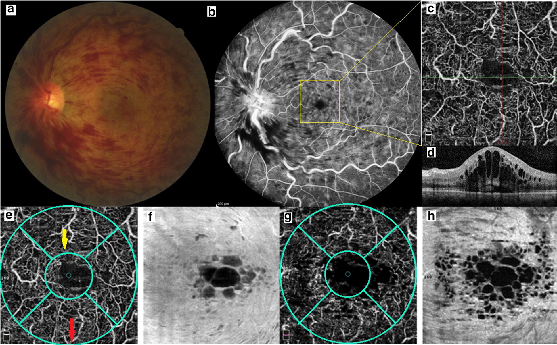 Fig. 1