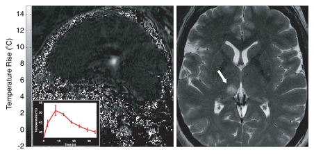 Figure 9: