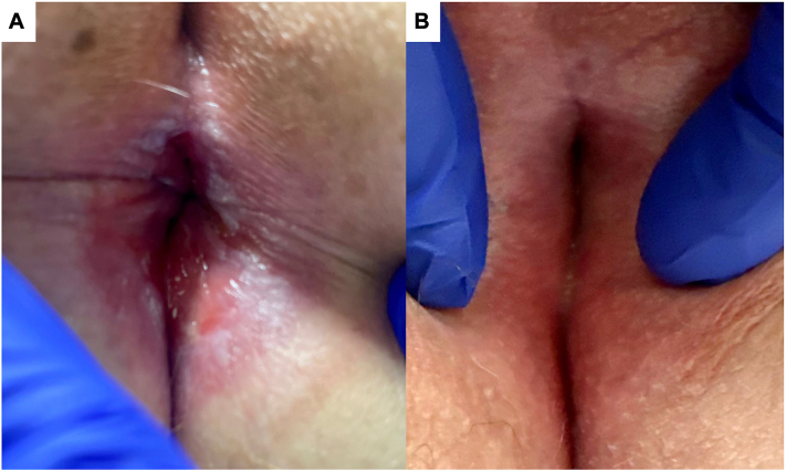 Fig 4