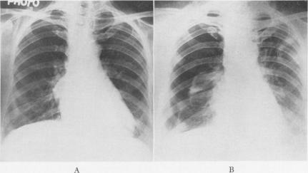 Fig. 5A (left).