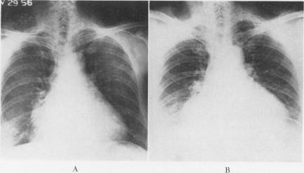 Fig. 2A (left) and 2B (right).