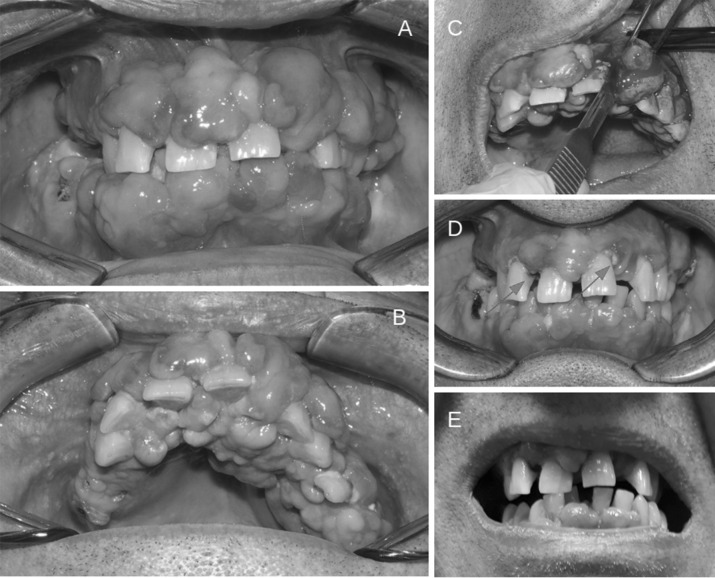 Fig. 1