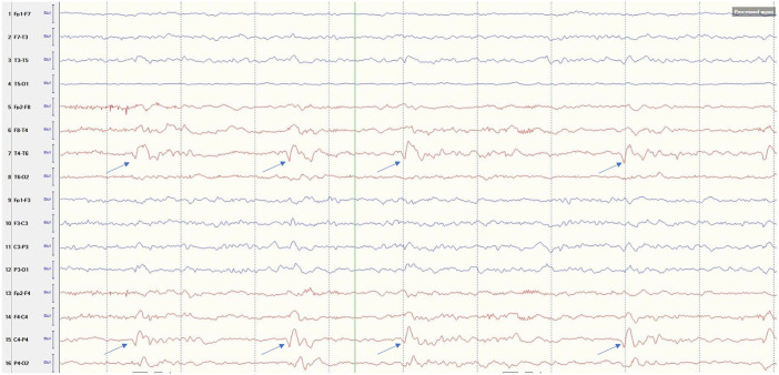 Figure 2.