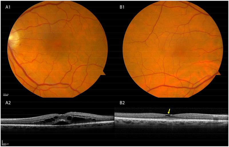 Figure 2: