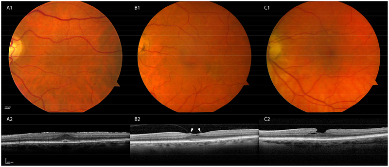 Figure 1: