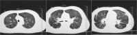 Fig. 2