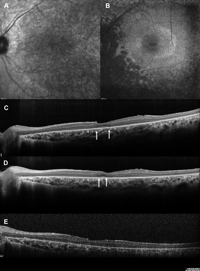 Figure 2