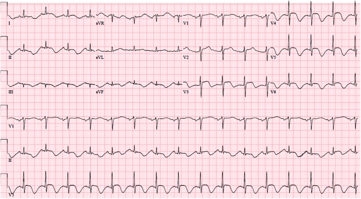 Figure 4