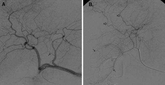 Fig. 4