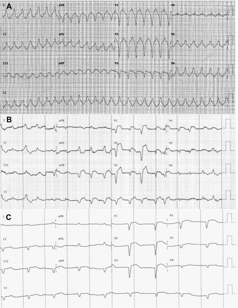 Figure 1