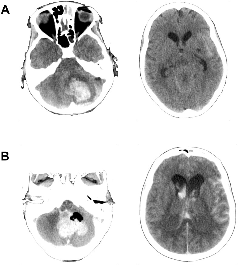 Fig 3